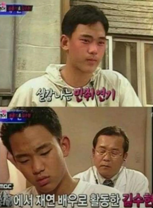 金秀贤整容前是个大鼻子。