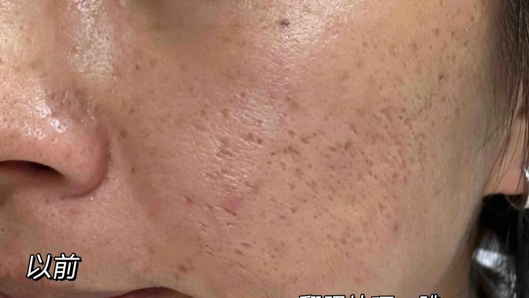 冬季护肤小妙招