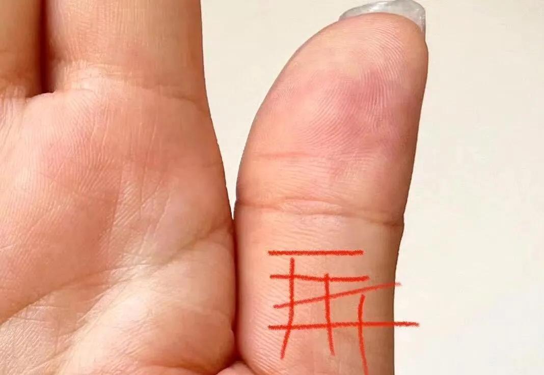 我没有啊
大拇指这个位置，如果这个位置有比较明显较深的横纹或者横竖相交的格子纹，