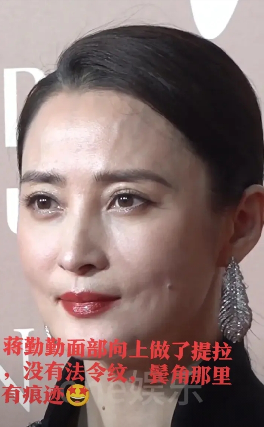 蒋勤勤没有皱纹，没有下垂，除了打针打得有点坑坑洼洼的，皮肤还好，可是还是有年龄感