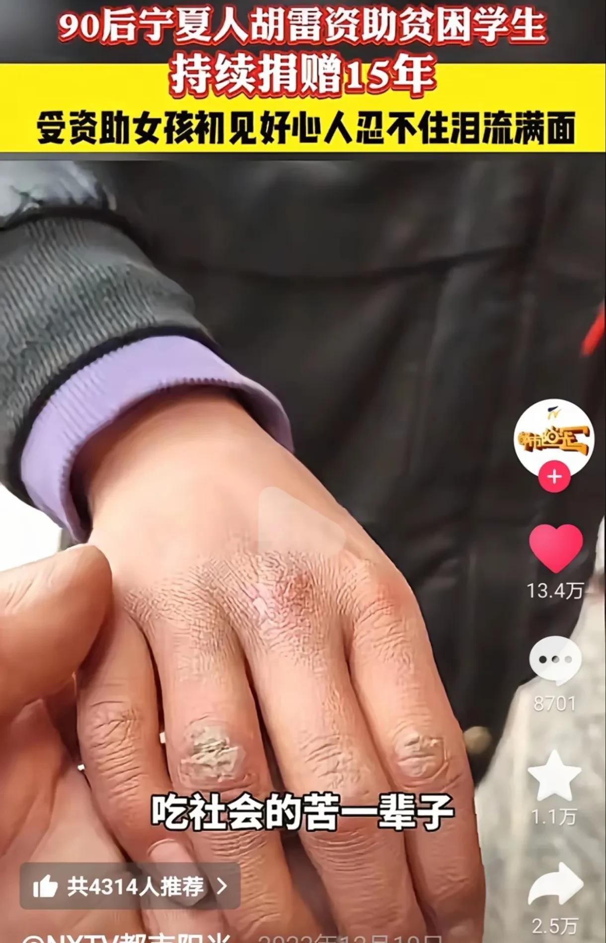 看到胡雷哭了，我没哭！
但看到小女孩满是伤痕的手，我哭了！
真的无法想象，小小年