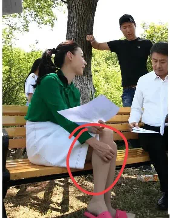我的天，张柏芝的手真的好有个人特色，这血管怎么这么突出，是不是患病了；

这