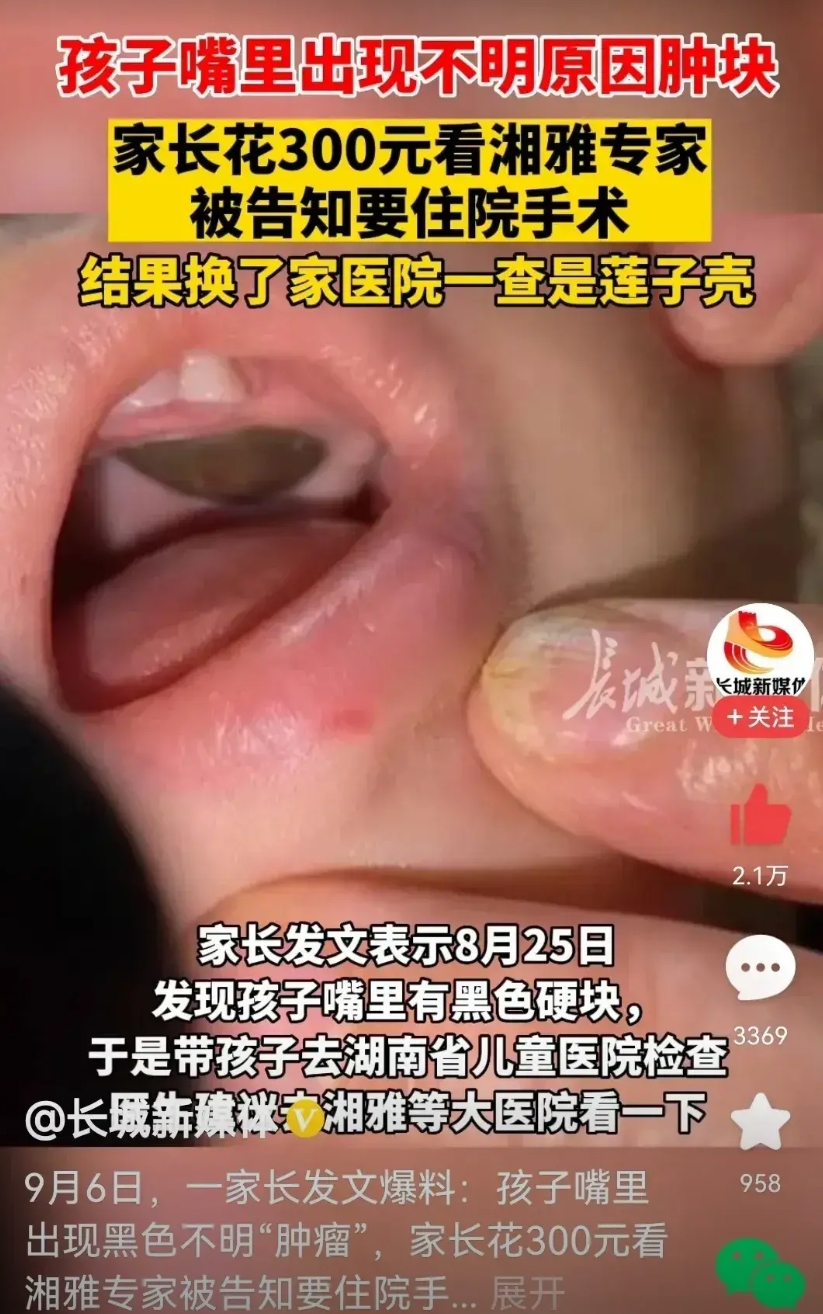 医疗市场化，天使变魔鬼。
曾经北协和南湘雅，医术因精湛而出名。
现在竟然……
孩