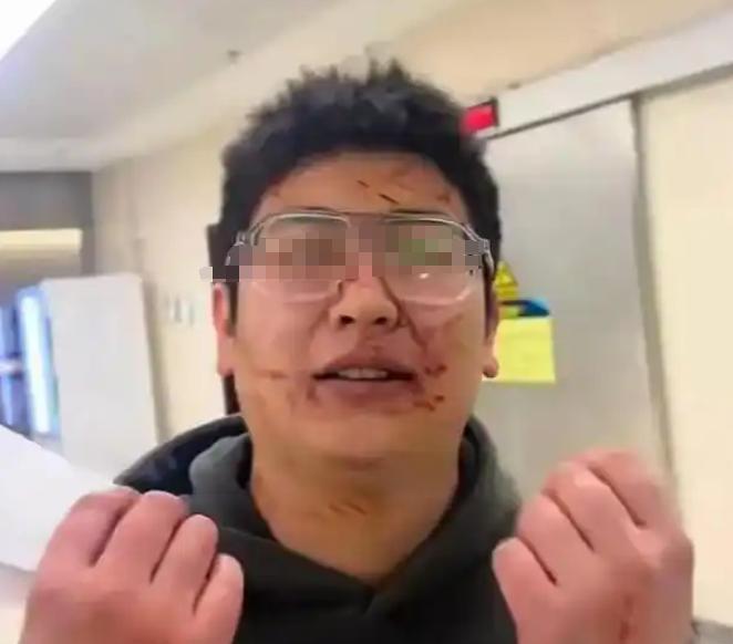 1月，男子过年回家拿东西，发现后妈擅自使用自己新婚时的被子，两人为此发生了争执，