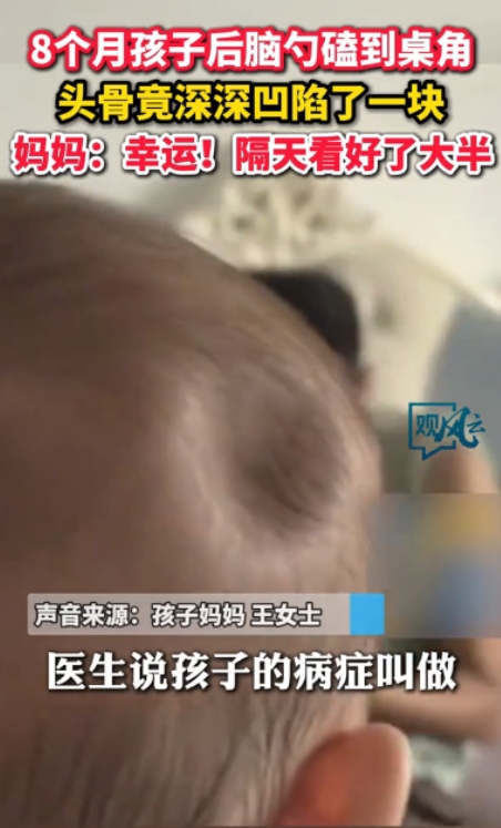 “不幸中的万幸！”5月23日，广东珠海，一名8个月大宝宝从沙发上摔下来，后脑勺重
