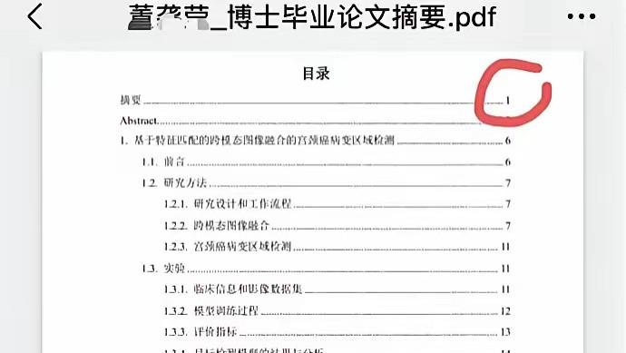 协和4+4医博遭质疑，董袭莹哥大本科有瑕疵、30页博士论文成笑谈
