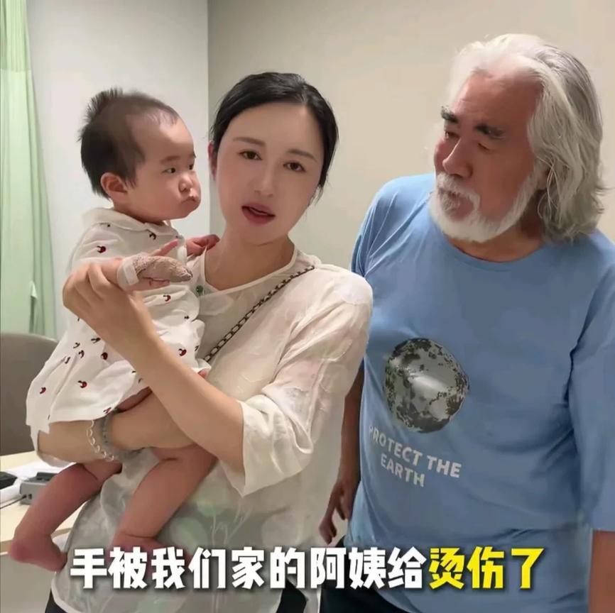 张纪中女儿被阿姨意外烫伤，小手上出现水泡，杜星霖心疼坏了！
7月3日，杜星霖在社