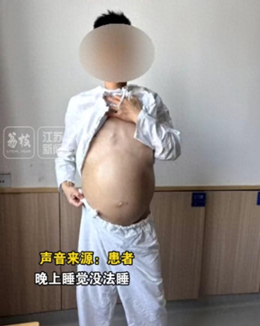 这就是不上厕所的下场！南京40岁男子4个月未排便，肚子胀的像临盆孕妇。医生历经3