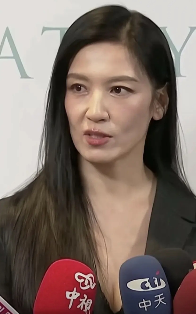 女人变老从哪里开始？看林熙蕾就知道了，不只是眼睛，皮肤五官整个都开始下滑下垂。要