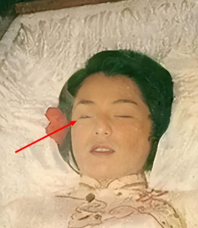 1985年，翁美玲服下安眠药后，又打开了煤气自杀，她去世时，脸上没有任何痛苦的痕