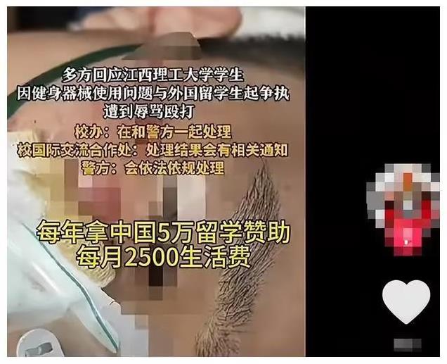 江西理工大学，花钱请人家来留学，结果本国学生被这些来留学的打得头破血流，这是什么