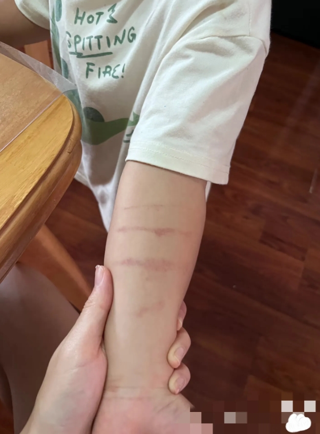 孩子被老师打了，该不该找老师理论呢？
今天孩子放学回到家，一脸委屈的跟我说，老师