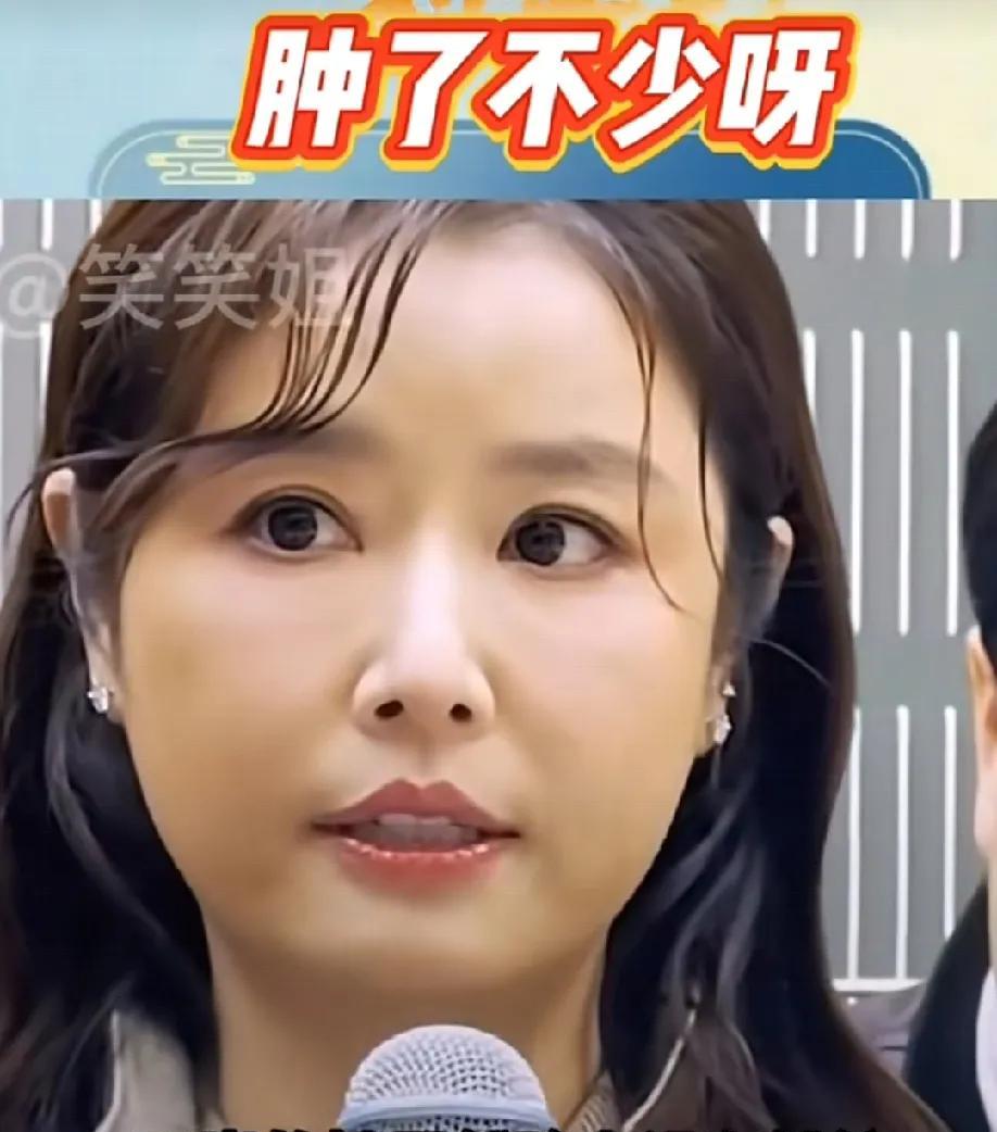 林心如怎么了[震惊]，怎么脸肿成了这样，难道这是胖的？可见和霍建华的婚姻生活十分