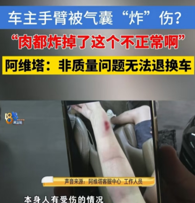 浙江，女子开车时发生碰撞，安全气囊没有包裹住方向盘，导致自己的手臂被炸伤，她怀疑