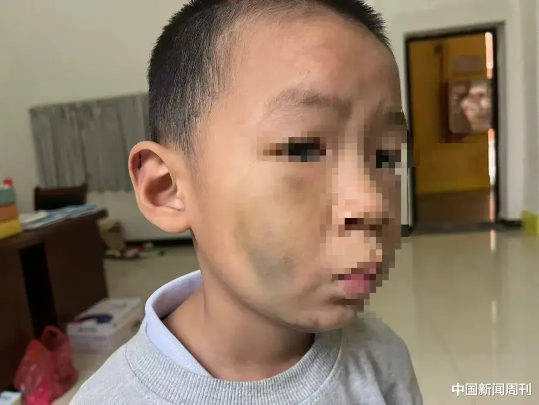 7岁男童被长期虐待？生父被刑拘