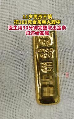“真要命！”25年江苏，11岁男孩贪玩将100克金条吞下，紧急送医2天也没能排出