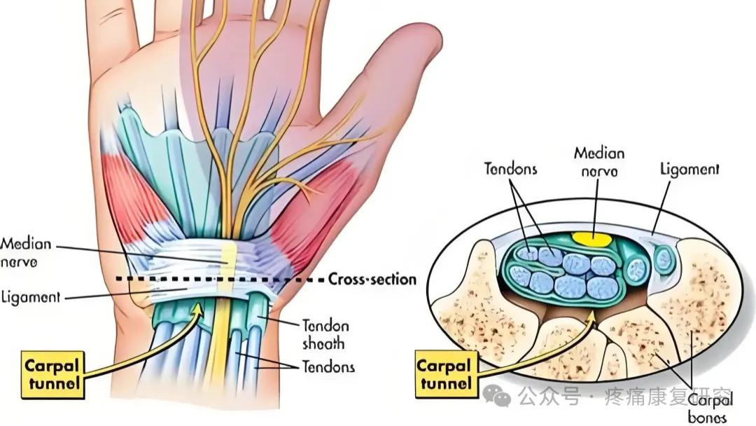 手背麻木、虎口刺痛？别漏了这个病