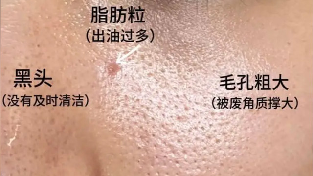 洗脸不对，保养作废！你的脸真的洗干净了吗？