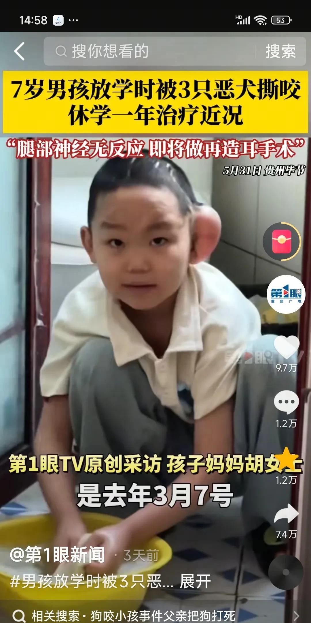 不忍心看啊！
这么可爱的孩子，放学路上被三只大狗攻击，咬的血肉模糊，一个耳朵都没