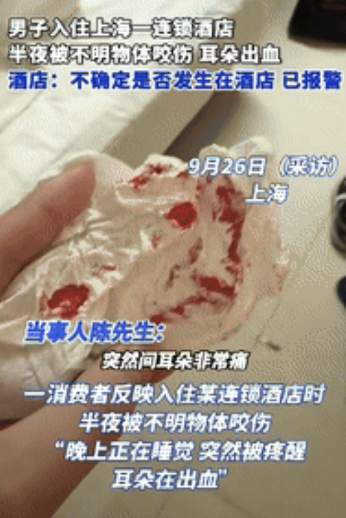 “倒大霉了！”上海一男子半夜在酒店休息时，突然感觉有东西在咬他耳朵，男子猛地张开