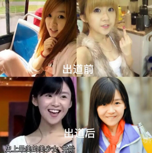 宋伊人16岁时的黑历史，你见过吗？

图一图二就是16岁时的她，惊讶吗？那时的她