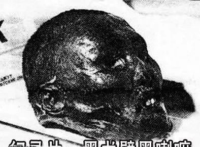 《浸泡在福尔马林里的血色传奇：一颗头颅揭开欧亚大陆最危险的秘密》
玻璃罐中的头颅