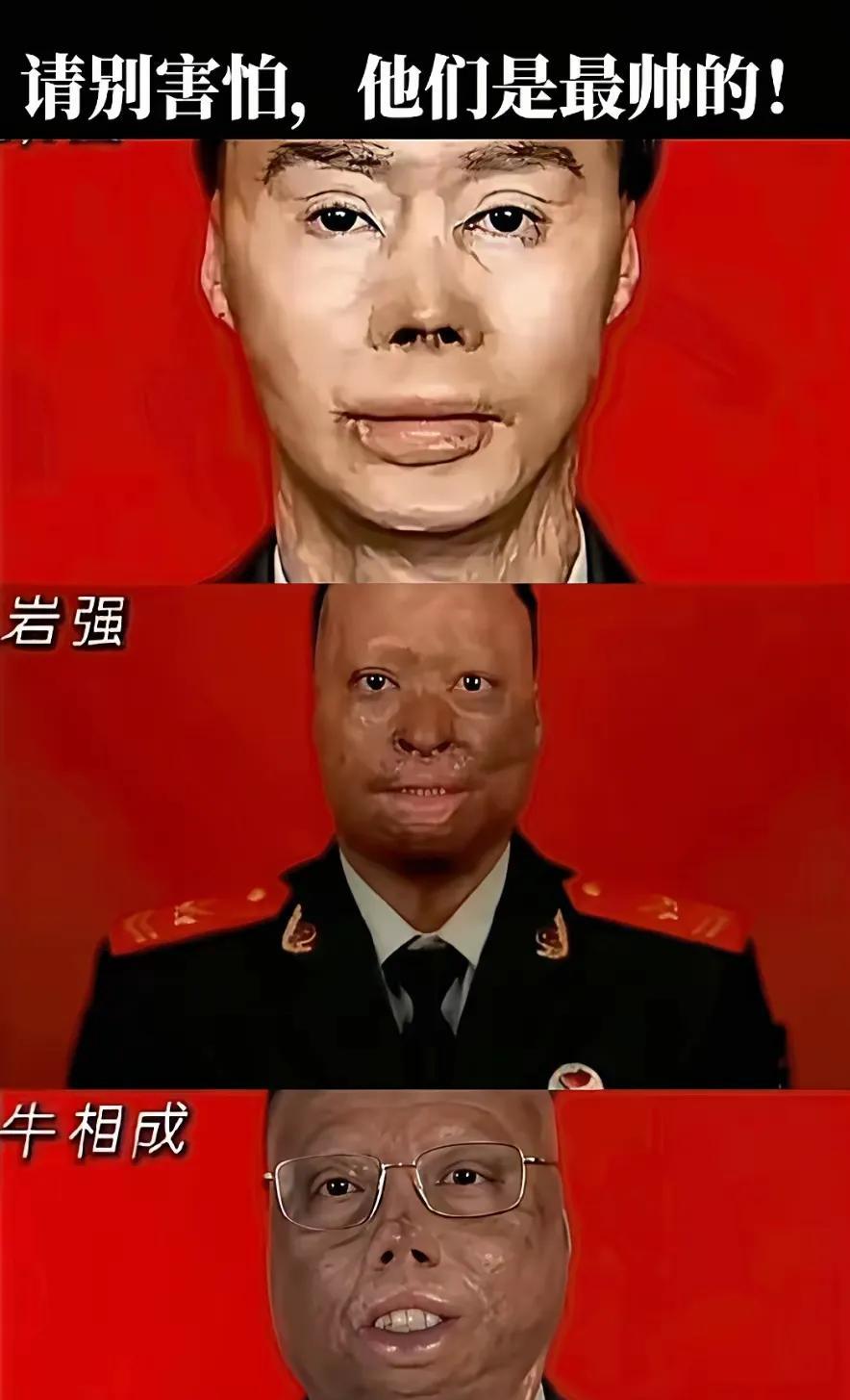 致敬英雄，无论他们容颜受损成什么样，在人民心中永远都是高大威猛，英姿飒爽！