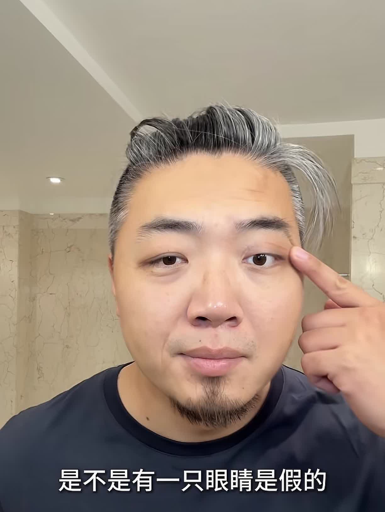 奕姐的儿子光总回应“假眼睛”的问题！

很多网友看了光总的眼睛，都觉得看着像