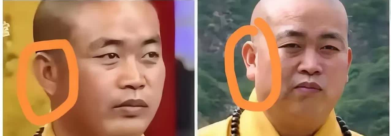 释永信的耳垂是假的？
网友说这是打了玻尿酸

为什么这样子说呢
有网友扒