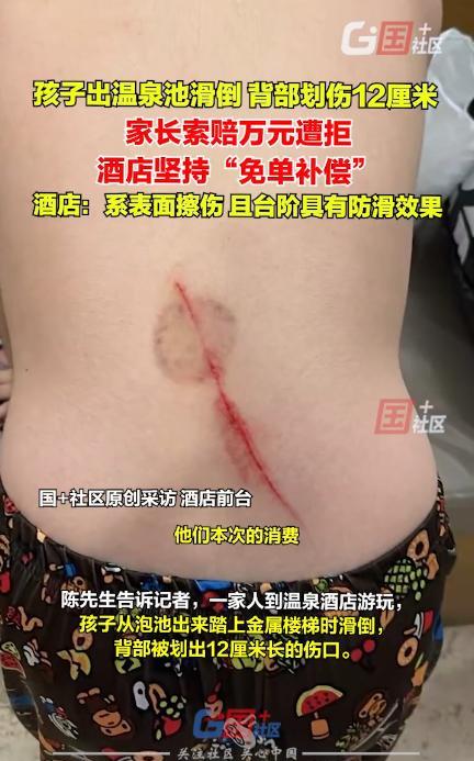 “还敢泡温泉吗？”近日，天津，8岁男孩泡温泉时不慎摔在了金属楼梯上，背上被划出一
