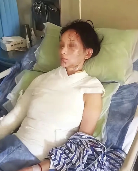 2015年，温州火锅店，一盆滚烫的菌汤，浇灭了32岁林女士的哺乳权，也浇出了服务
