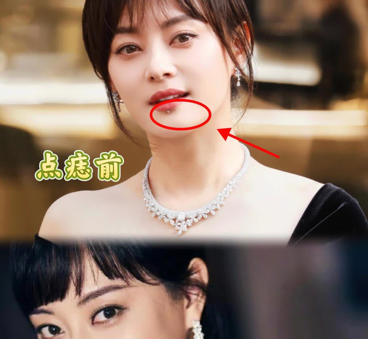 孙俪把唇下痣切了，
不是因为怕影响颜值。
 
      这颗痣并非天生，