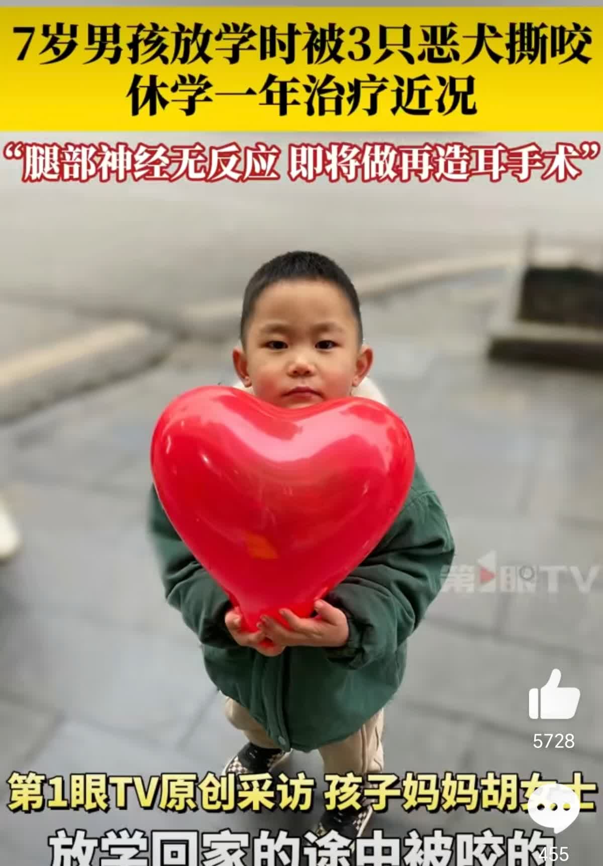 贵州，7岁男孩被3只恶犬撕咬一年后近况:需做再造耳，狗主人却只赔5万。

去
