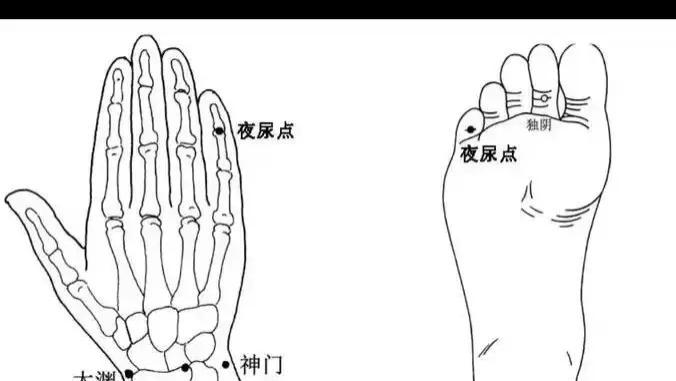 一位名医治遗尿漏尿奇穴针灸方法