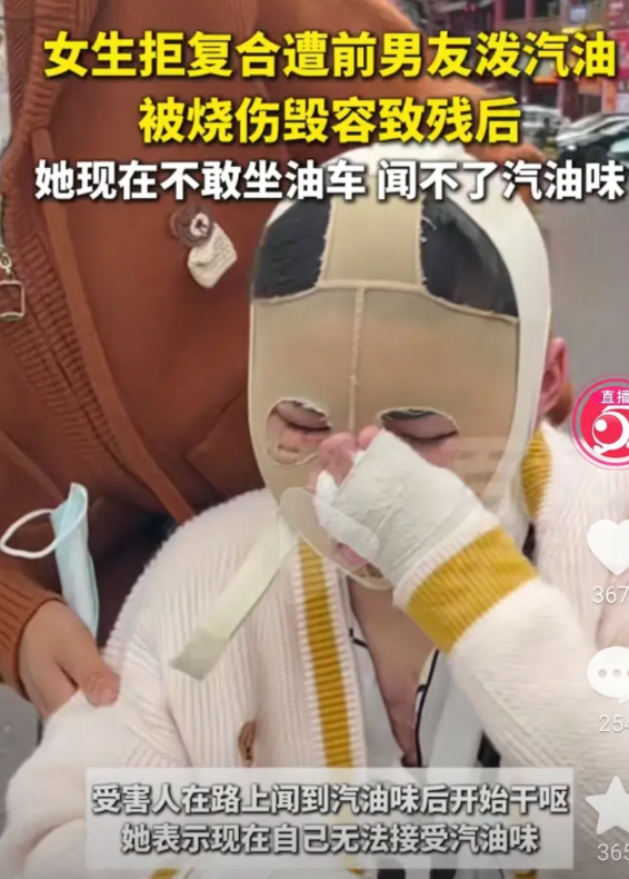 陈杨梅被泼汽油致残案二审开庭更多细节被披露出来！
1 信息披露因女方提到要告小覃