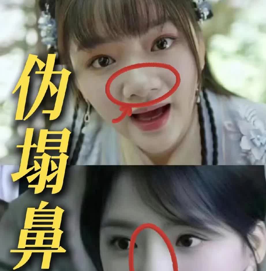 你以为自己鼻子塌？其实是被它骗了！
任敏的鼻子一直被人诟病，其实她不是鼻子塌

