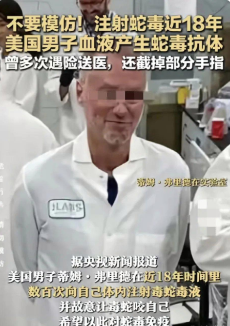太狠了，美国有个男的在家养了好几十条毒蛇，18年里为了抗蛇毒，他竟然给自己打了好