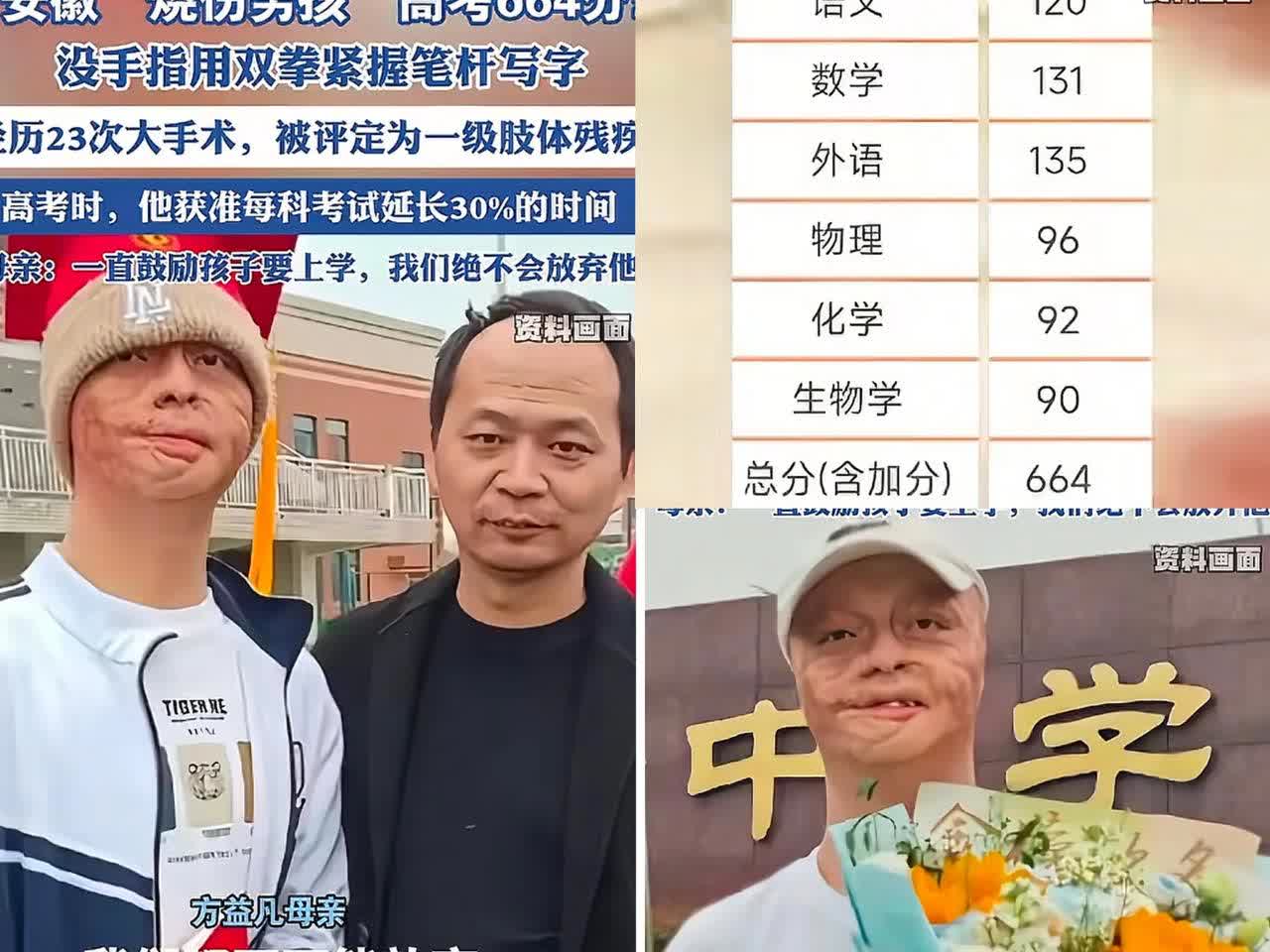 烧伤男孩方益凡高考664分
安徽男孩方益凡6岁时在舅舅家做客，因舅舅与一名男子