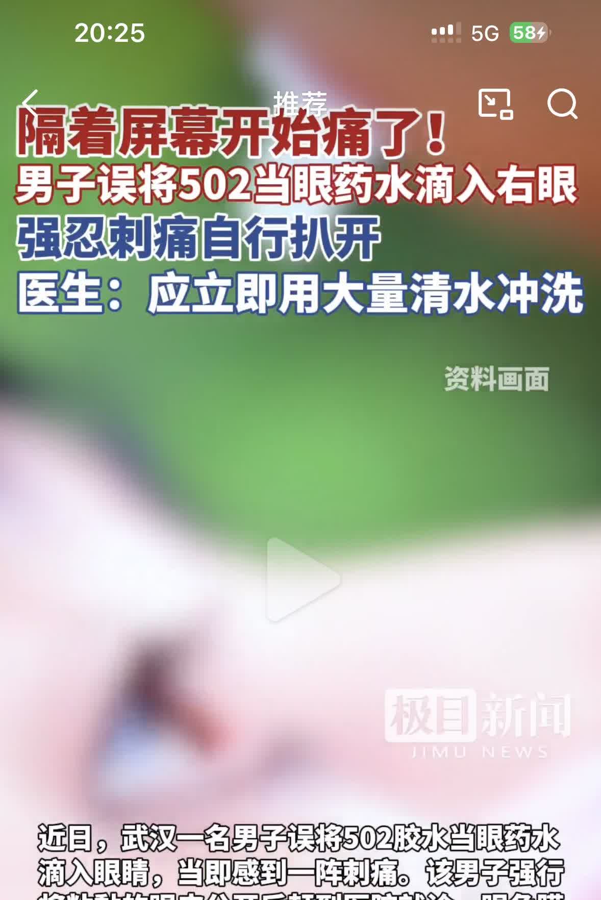 隔着屏幕都能感觉到疼！这得多么粗心大意的人才能做出来这种事
一男子把502胶水