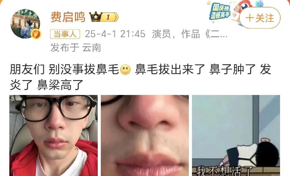 费启鸣：别没事拔鼻毛！
4月1日，费启鸣在社交平台晒出了自拍照，鼻子红肿，这是咋
