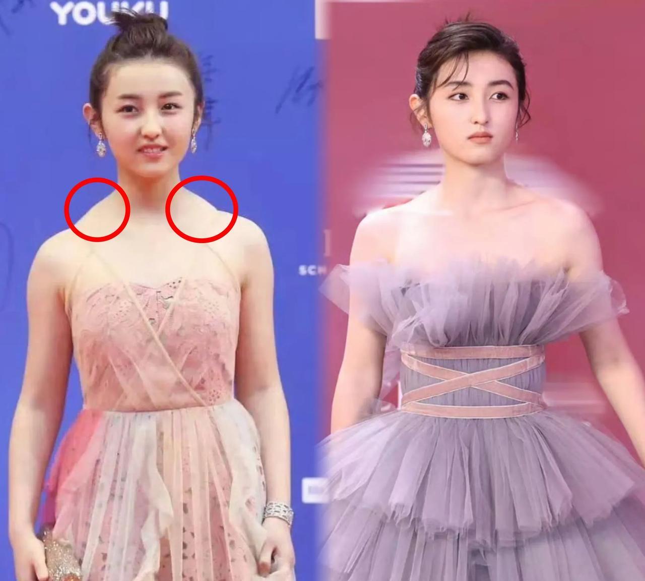张子枫这小姑娘对自己真够“狠”的！
几年前走红毯因为肩膀上的“富贵包”、驼背等仪