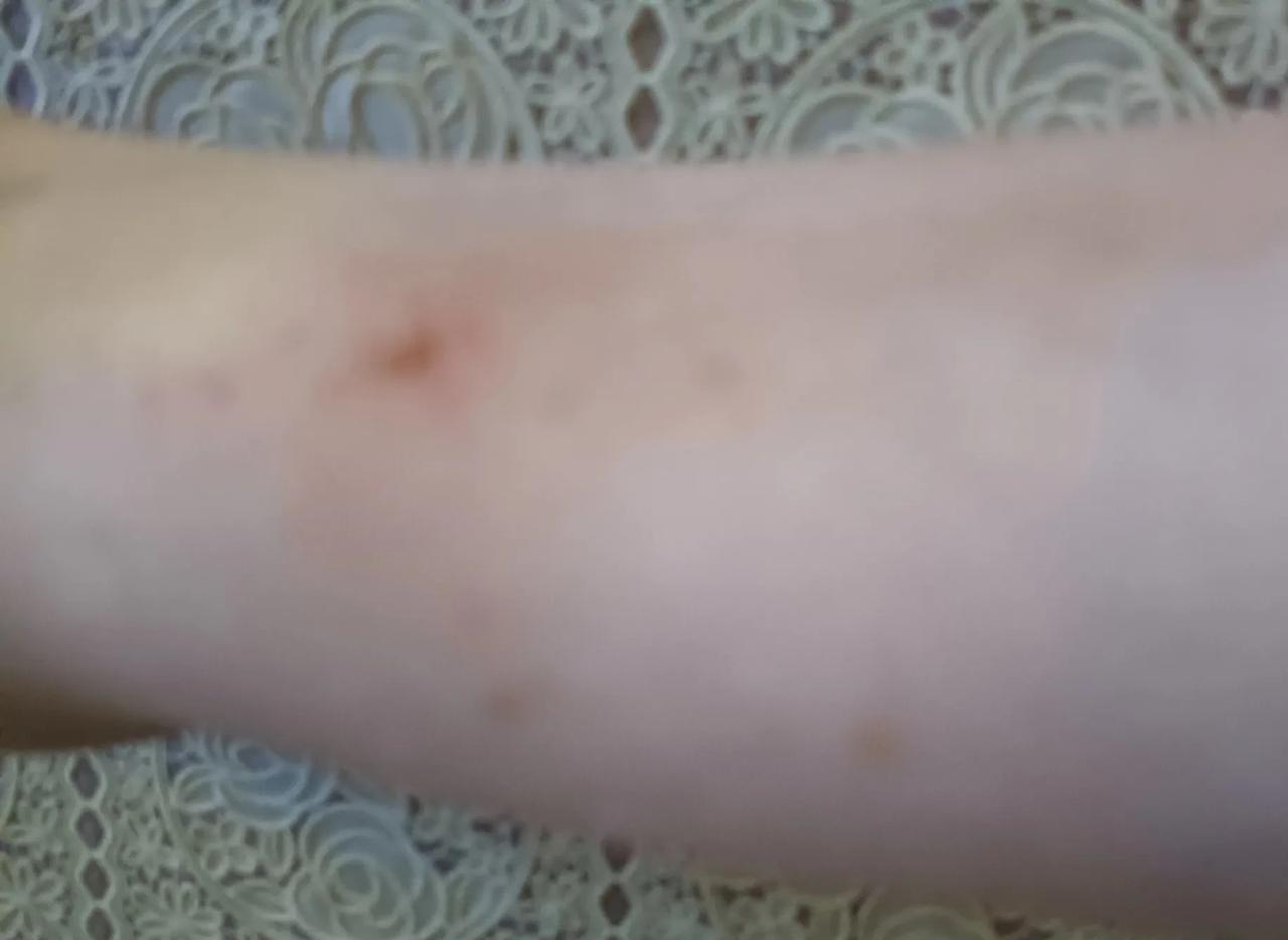 电梯里贴了张粉色的纸，意思是宣传小心蚊子咬，小心登革热什么的。
这两天我们还在说