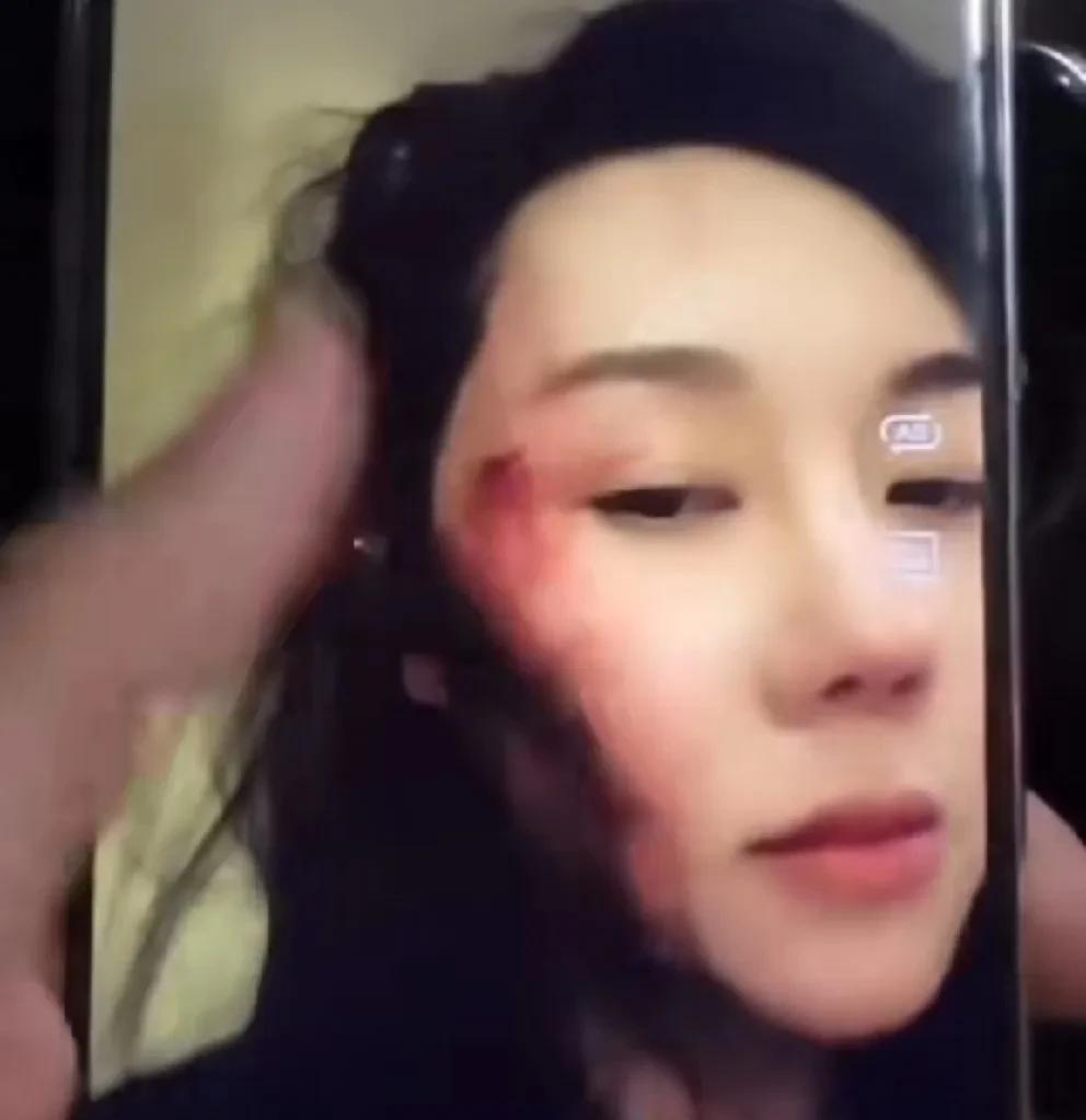 “赵四”儿子刘程人设塌房，晒伤怒揭家暴行为，动Dao威x、辱M丈母娘。
    