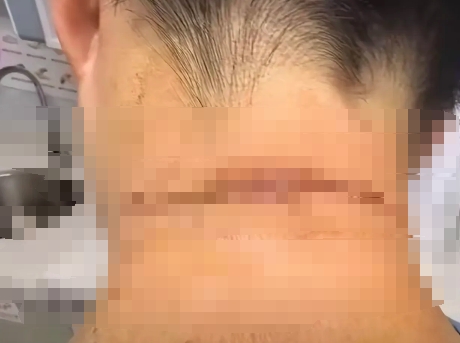 半个月前，家住杭州临平的王女士回了一趟乡下，晚上在母亲家吃饭的时候，突然感觉后脖