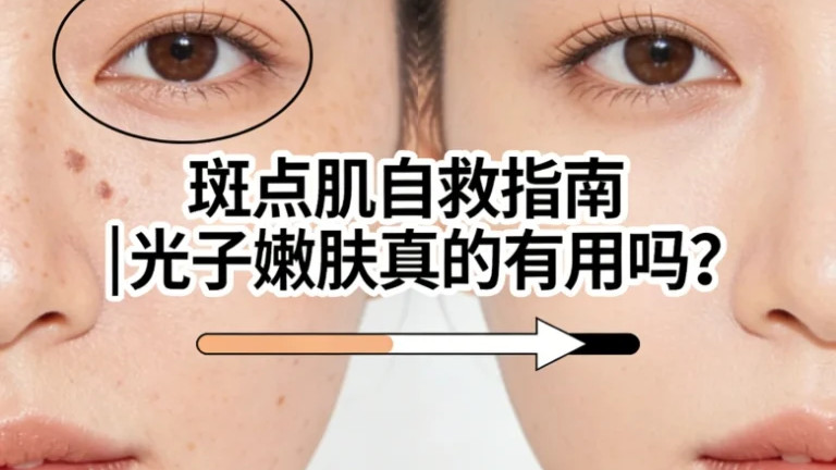 有斑可以做光子嫩肤吗？白白兔来告诉你