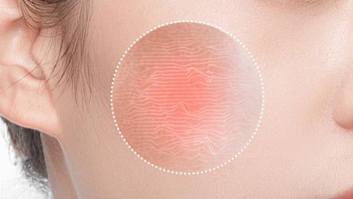 杜一生科普：皮肤屏障，你的皮肤 “保护墙”