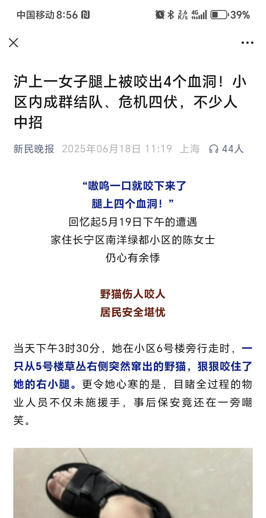 上海一女子腿上被流浪猫咬出四个血洞。
消息来自新民晚报微信公众号发布的文章。物业