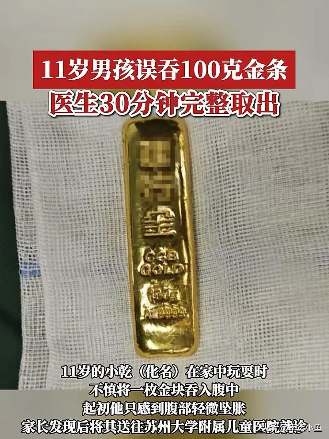 近日，江苏11岁小男孩在家中“吞金”
自己玩耍时，将100克金条吞了下去
医生3