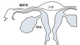 昆明送子鸟：不孕不育“来势汹汹”？一起揭开“不孕之谜”！