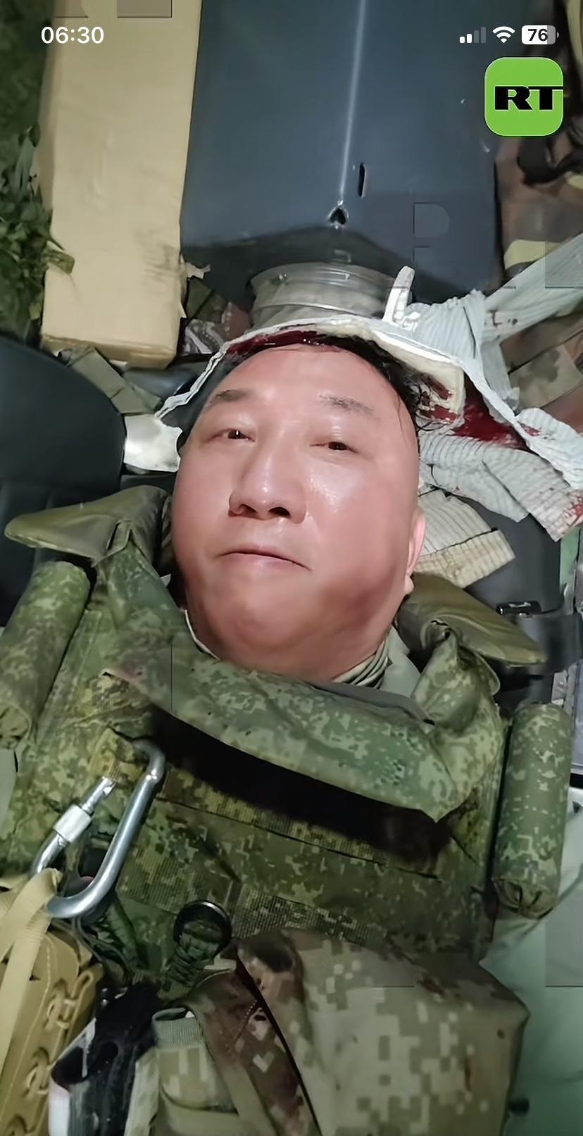 好担心啊！卢记者前线报道时受伤，没说是怎受的伤，脑袋上包上了纱布，整个人感觉有点